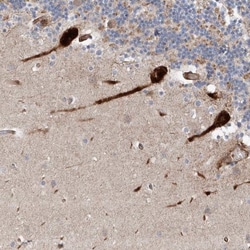 USF3 Antibody, Novus Biologicals 0.1mL; Unlabeled:Antibodies, Polyclonal